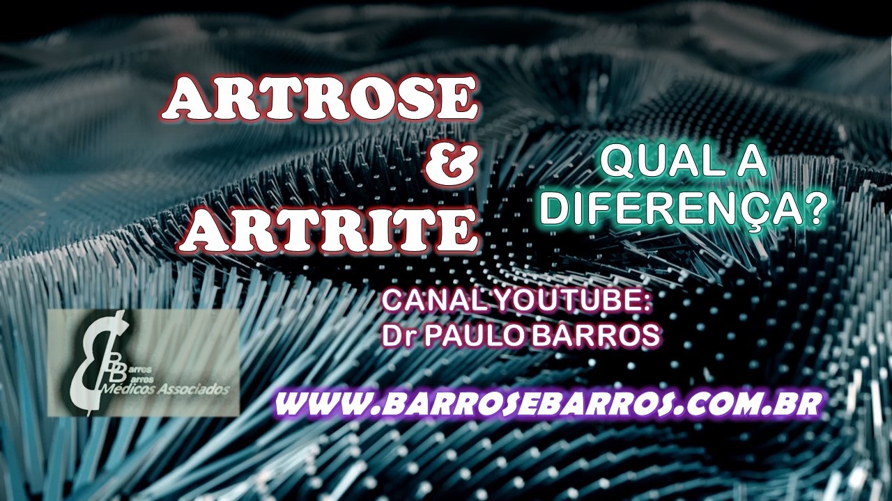 ARTRITE OU ARTROSE?